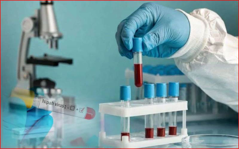 مغربی بنگال میں نپاہ وائرس کے دو کیسز پائے گئے، محکمہ صحت  الرٹ ،ہیلپ لائن نمبر جاری